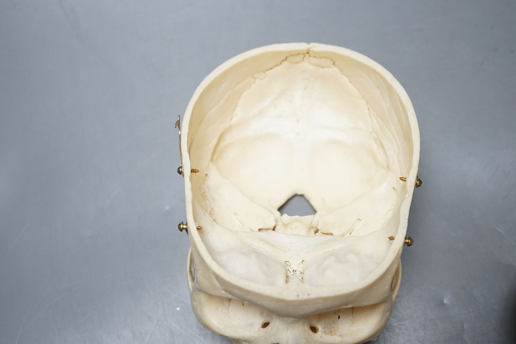 A human skull, acquired c.1976., 14 cms high x 19.5 wide.